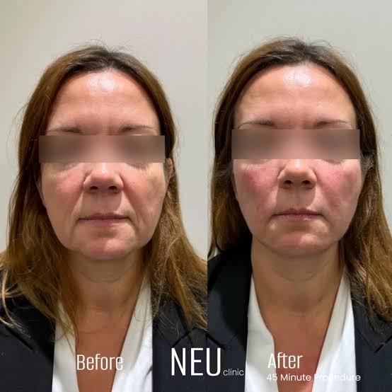 Non Surgical