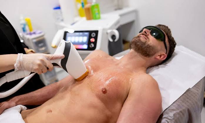 Laser Hair Removal
