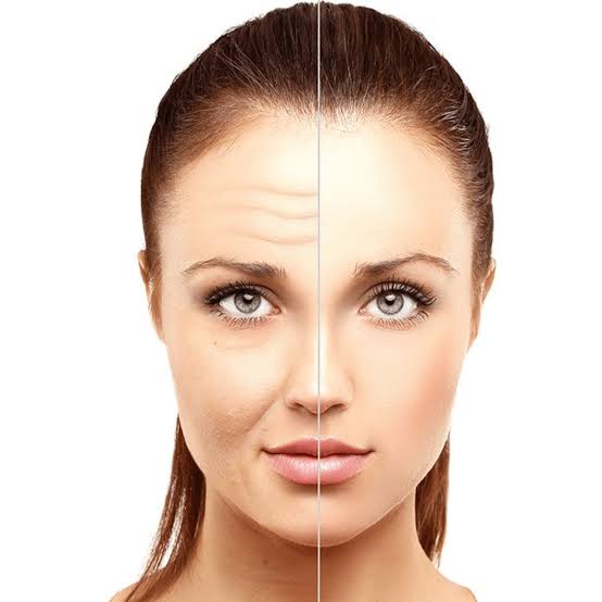 Anti Aging
