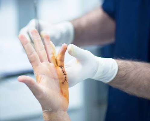 Hand Surgery