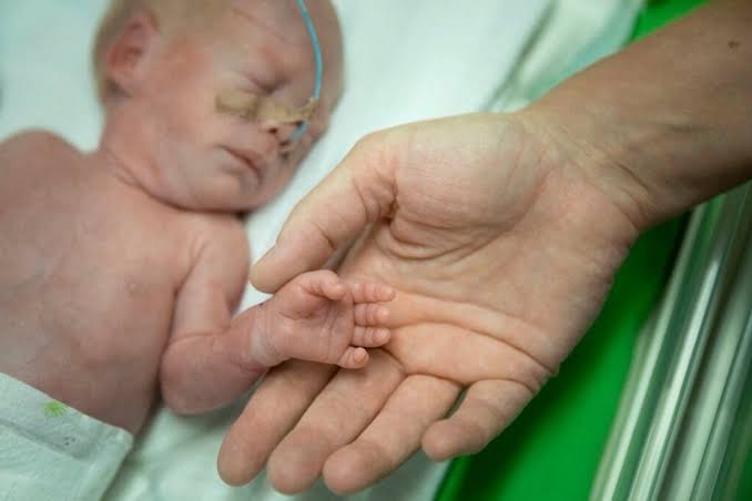 Congenital Defects