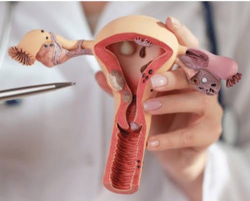 Vaginoplasty